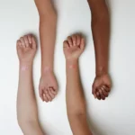 بالم لب حرارتی اسنس