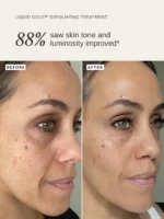 لایه بردار حاوی ۵٪ اسید گلیکولیک از برند ALPHAH