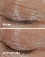 کرم دور چشم repairwear laser focus کلینیک