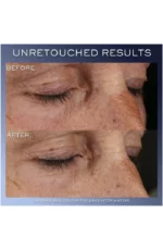 کرم دور چشم جوان کننده و روشن کننده ژنفیک لانکوم