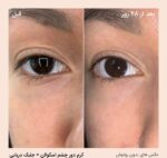 کرم دور چشم سفت کننده حاوی اسکوالن و جلبک دریایی بایوسانس