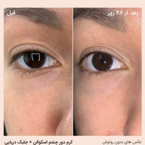 کرم دور چشم سفت کننده حاوی اسکوالن و جلبک دریایی بایوسانس