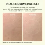 بوستر شات روشن کننده دور چشم و صورت و نواحی تیره بدن ویتامین سی آرنسیا Arencia